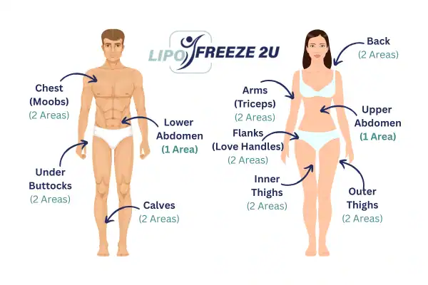 Areas you can have fat freezing treatment Shropshire