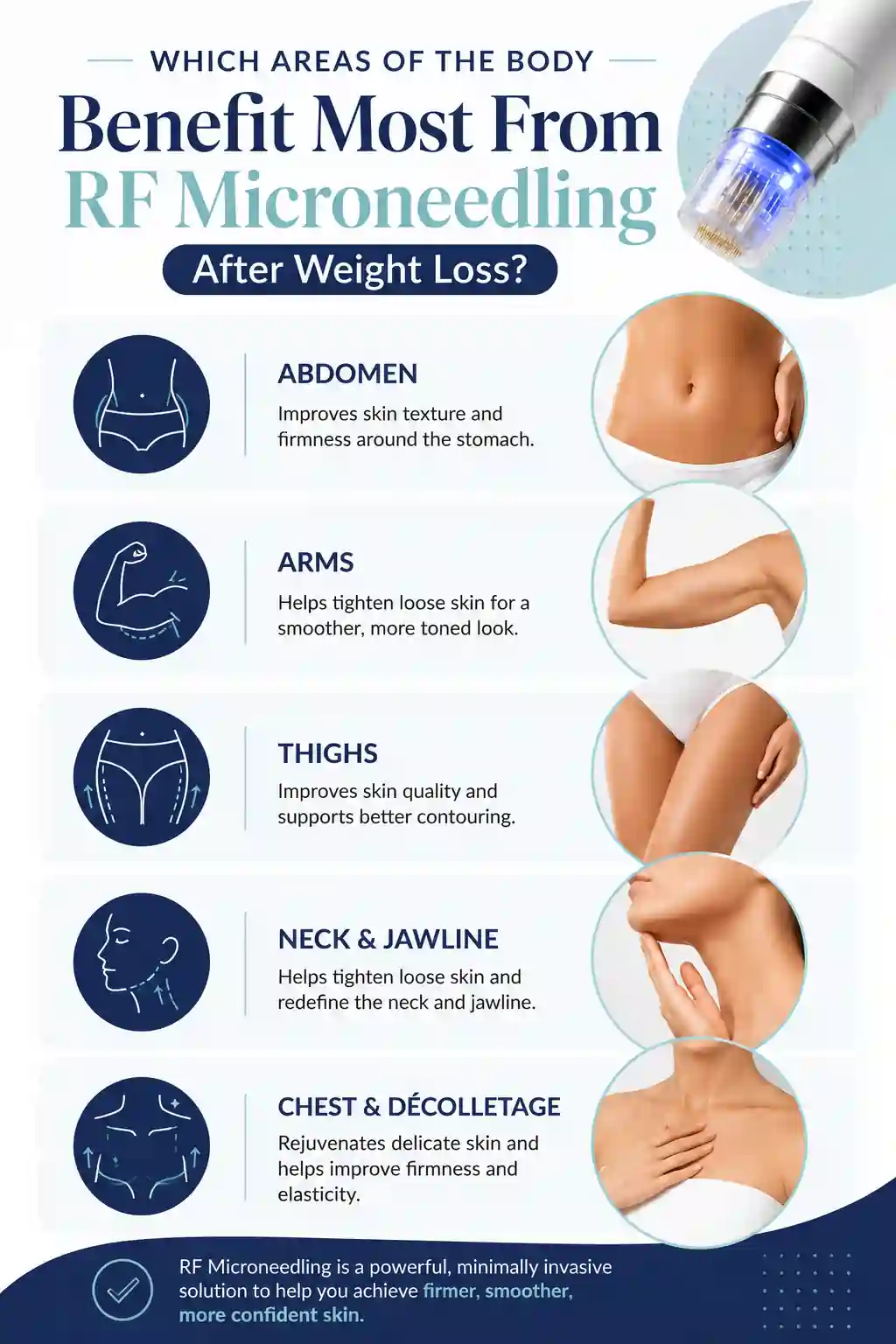 Which Areas of the Body Benefit Most From RF Microneedling After Weight Loss Shropshire